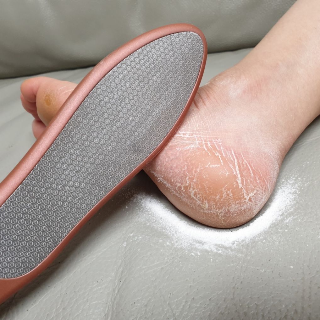 발각질제거 풋파일 풋브러쉬 로즈골드 기 발뒷꿈치각